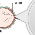 Onderdelen oog